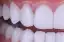 Sonhar com dentes, péssimo agouro, contrariedades, dificuldades, luto, infortúnio. Dentes brancos, um desejo será realizado. Dente de ouro, corrupção e tristeza.